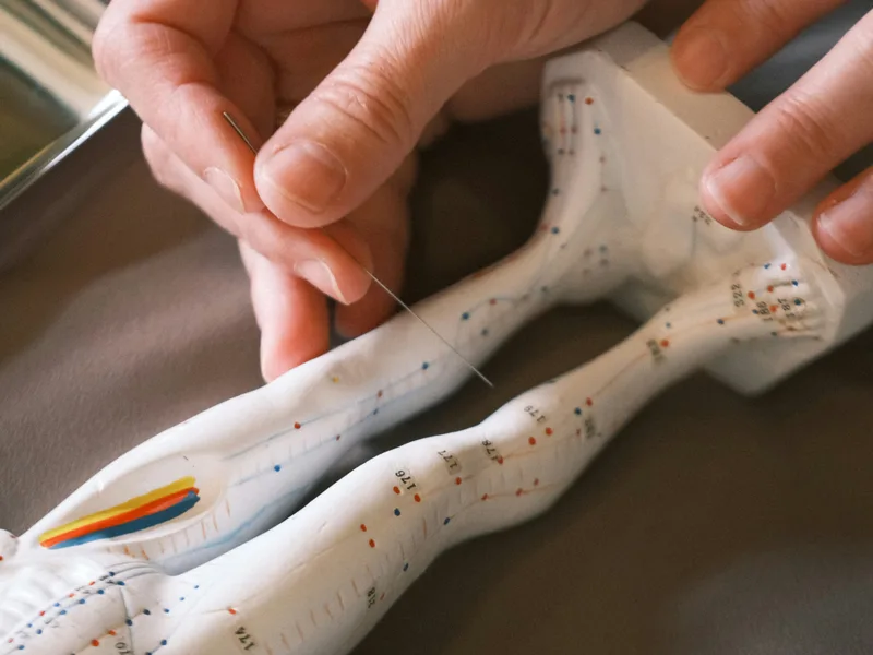 Acupuncture at Mulberry Chiropractic in Houston