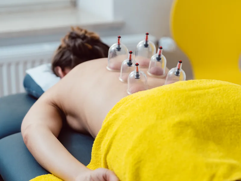 Cupping Therapy at Mulberry Chiropractic in Houston