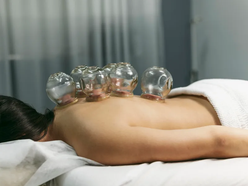 Cupping Therapy at Mulberry Chiropractic in Houston