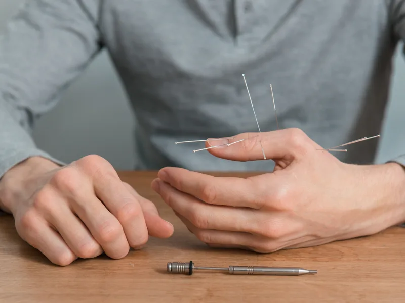 Dry Needling at Mulberry Chiropractic in Houston