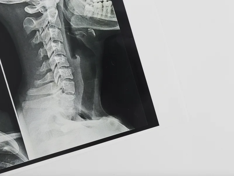 X-Rays at Mulberry Chiropractic in Houston