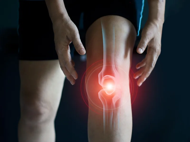 How Mulberry Chiropractic treats arthritis in Houston